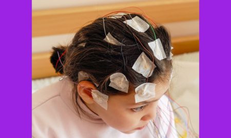 child/youth epilepsy healthcare improvement and access grants; young girl with EEG electrodes on head
