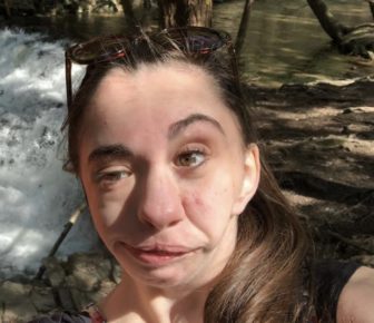DisabledSpeakOut_Liz Adam's podcast, Courageously Kind, is about how lives with a genetic disorder that disfigured the right side of her face.