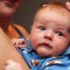 Childhood eczema research support grants: baby with eczema on face being held by mother